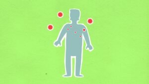 measles outbreak health — Photo by Monstera Production on Pexels